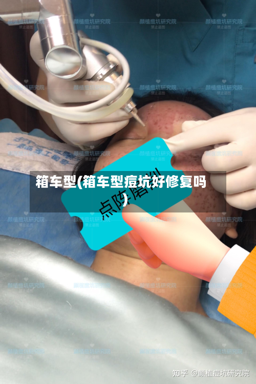 箱车型(箱车型痘坑好修复吗)